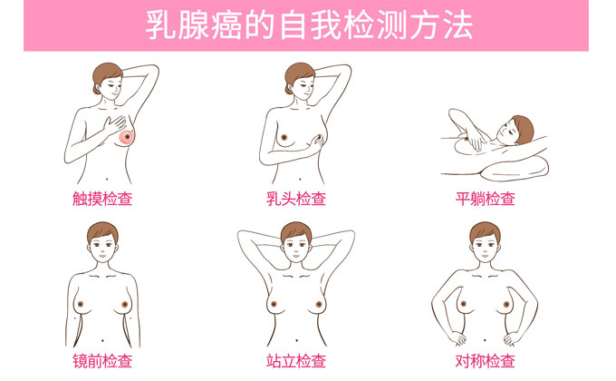 乳腺癌有征兆吗？是否可以自查？